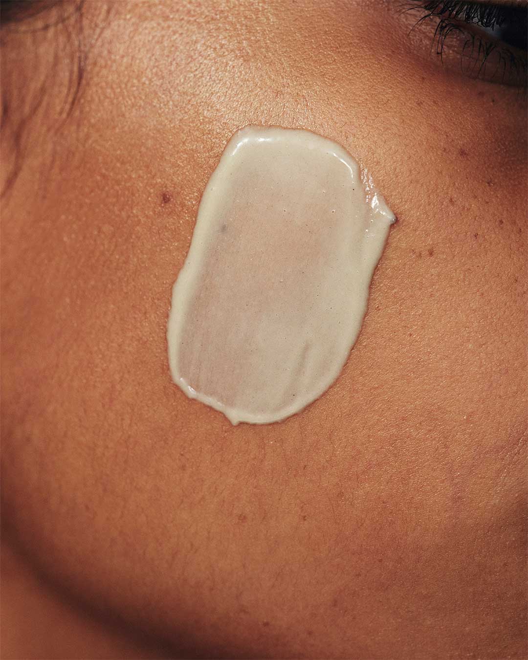 Dermalogica